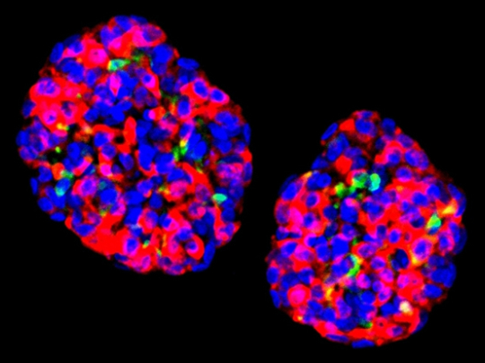 Vědci přetvořili lidské žaludeční buňky, aby vyráběly inzulín, a zvrátili tak cukrovku u myší