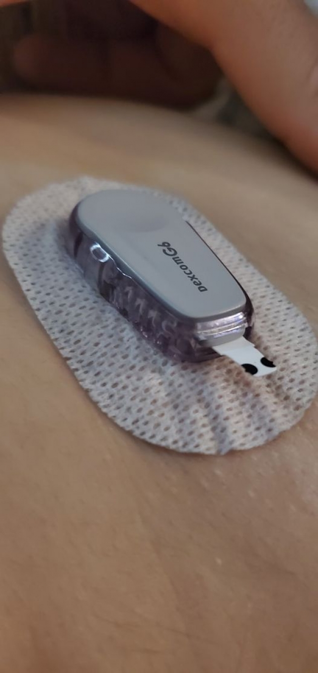 Установка dexcom g6 на айфон